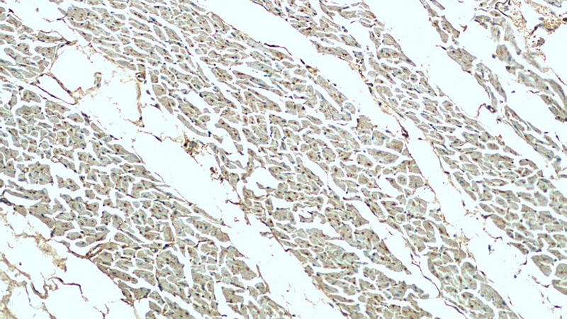 Immunohistochemistry of paraffin-embedded human heart tissue slide using Catalog No:113306(NOSTRIN Antibody) at dilution of 1:200 (under 10x lens).