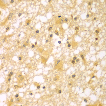 Immunohistochemistry - PAK6 Polyclonal Antibody 