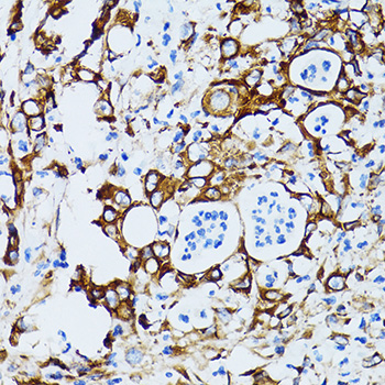 Immunohistochemistry - RPL6 Polyclonal Antibody 
