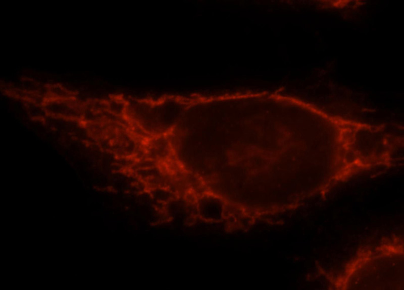 Immunofluorescent analysis of Hela cells, using CPT1A antibody Catalog No:109530 at 1:25 dilution and Rhodamine-labeled goat anti-rabbit IgG (red).