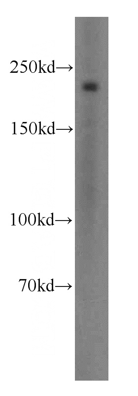mouse colon tissue were subjected to SDS PAGE followed by western blot with Catalog No:115390(MYH11 antibody) at dilution of 1:400