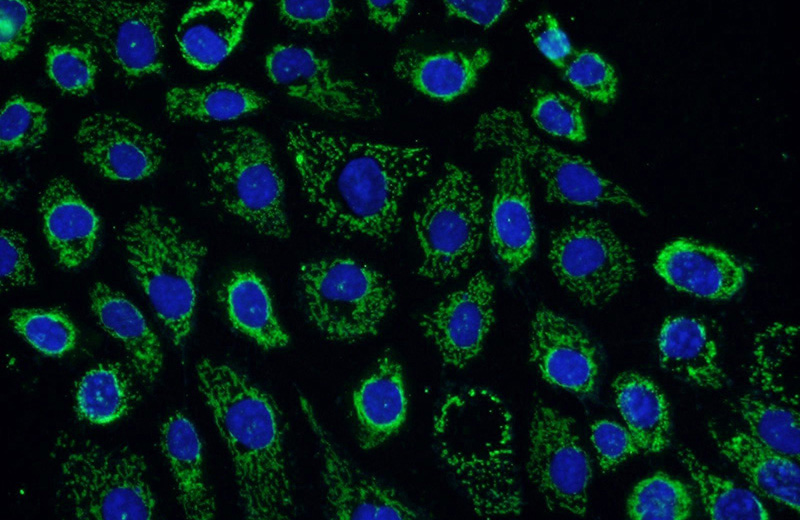 Immunofluorescent analysis of A431 cells using Catalog No:112316(LRCH3 Antibody) at dilution of 1:25 and Alexa Fluor 488-congugated AffiniPure Goat Anti-Rabbit IgG(H+L)