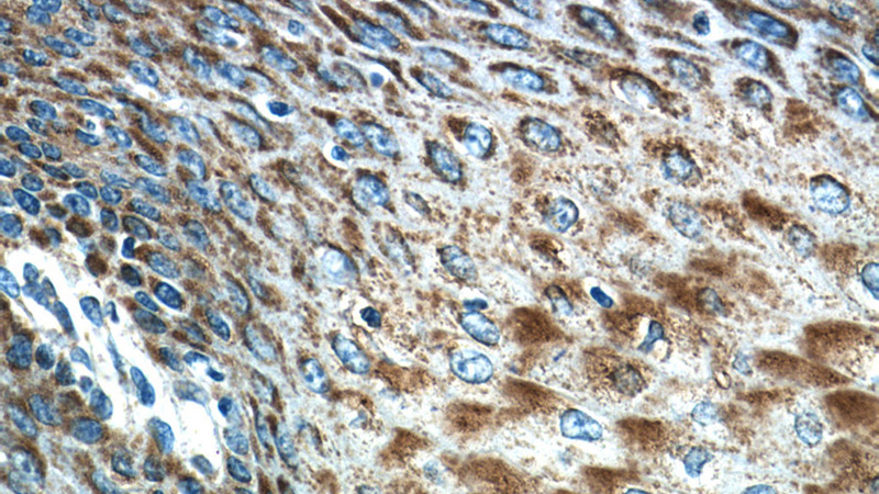 Immunohistochemistry of paraffin-embedded human oesophagus tissue slide using Catalog No:111742(IL1F9 Antibody) at dilution of 1:50 (under 40x lens)