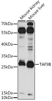 Western blot - TAF9B Polyclonal Antibody 
