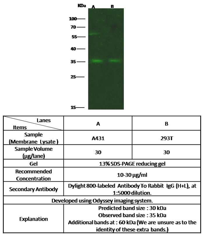 FcERI / FCER1A Antibody, Rabbit PAb, Antigen Affinity Purified, Western blot