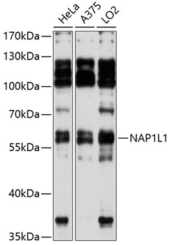 Western blot - NAP1L1 Polyclonal Antibody 