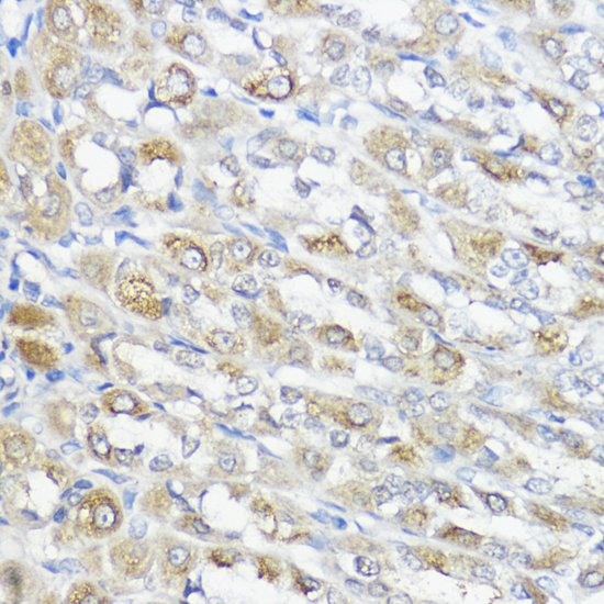 Immunohistochemistry - GPX2 Polyclonal Antibody 