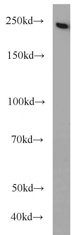 HeLa cells were subjected to SDS PAGE followed by western blot with Catalog No:114235(PRPF8 antibody) at dilution of 1:800