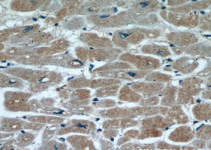 Immunohistochemical of paraffin-embedded human heart using Catalog No:111946(ITGB1BP1 antibody) at dilution of 1:50 (under 40x lens)