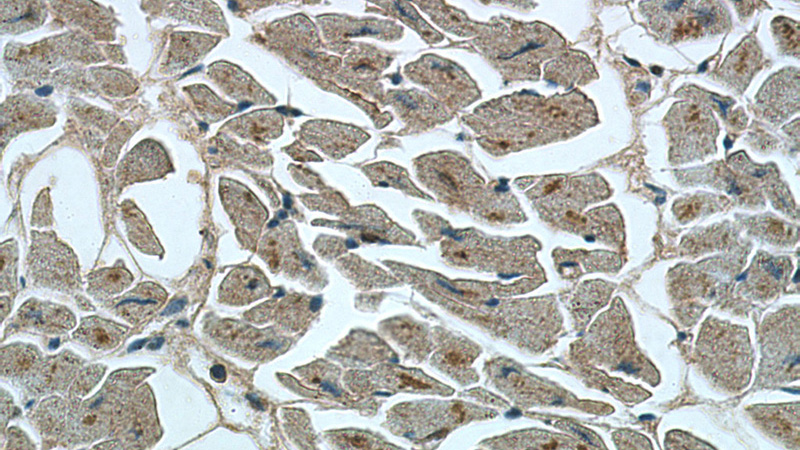 Immunohistochemistry of paraffin-embedded human heart tissue slide using Catalog No:114949(RYR2 Antibody) at dilution of 1:200 (under 40x lens).