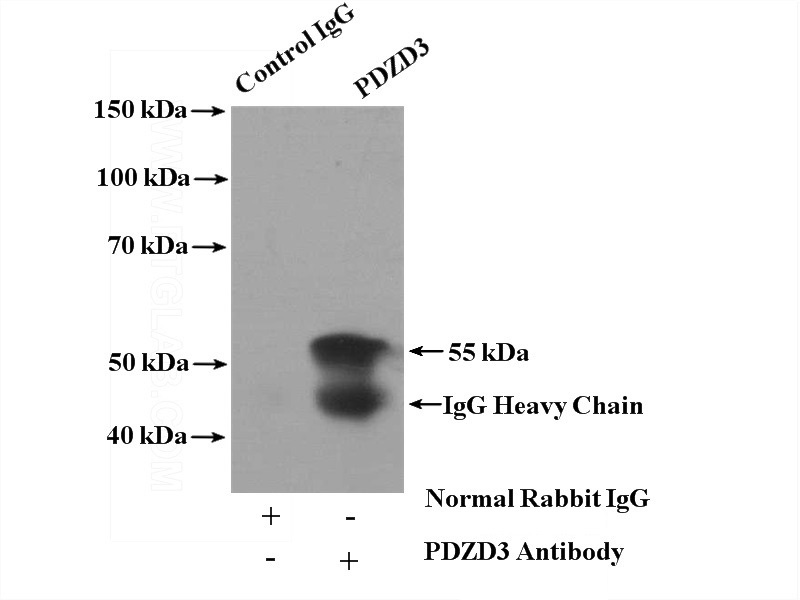 IP Result of anti-PDZD3 (IP:Catalog No:113644, 4ug; Detection:Catalog No:113644 1:500) with mouse kidney tissue lysate 4800ug.
