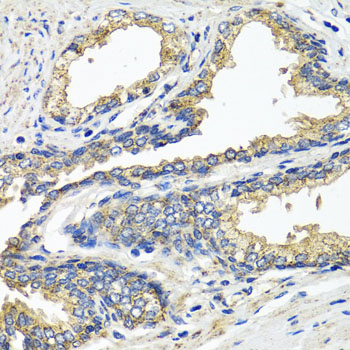 Immunohistochemistry - ETFA Polyclonal Antibody 