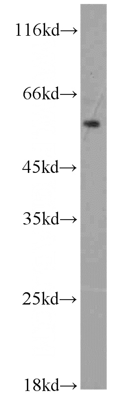 mouse testis tissue were subjected to SDS PAGE followed by western blot with Catalog No:107765(ADAM2 antibody) at dilution of 1:1000