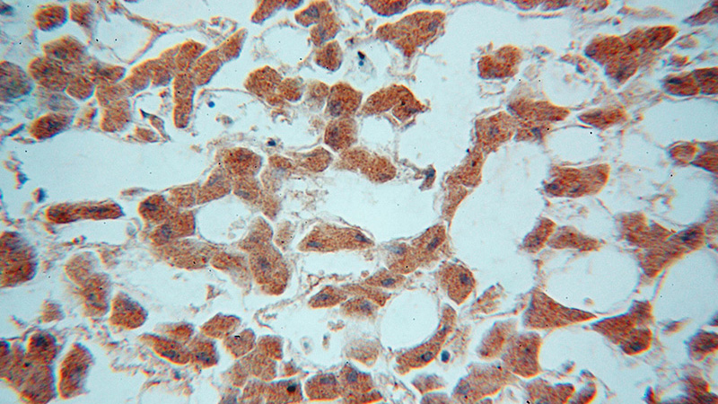 Immunohistochemical of paraffin-embedded human liver using Catalog No:116298(TRIM14 antibody) at dilution of 1:100 (under 40x lens)