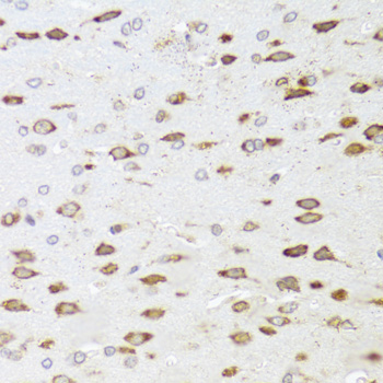 Immunohistochemistry - ARHGAP5 Polyclonal Antibody 