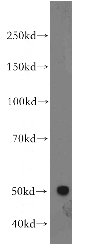 COLO 320 cells were subjected to SDS PAGE followed by western blot with Catalog No:115378(SLC44A1 antibody) at dilution of 1:500