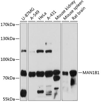 Western blot - MAN1B1 Polyclonal Antibody 