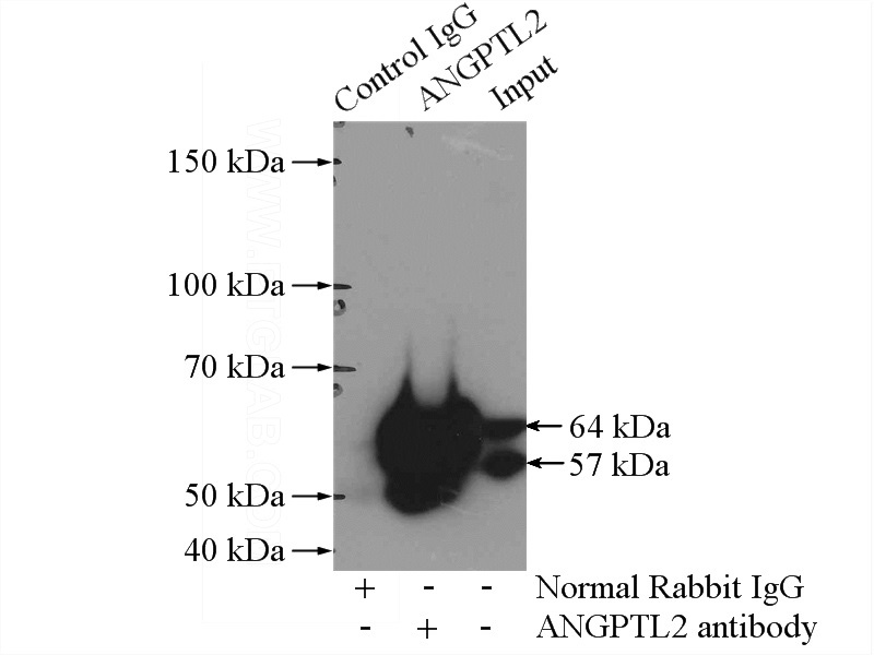 IP Result of anti-ANGPTL2 (IP:Catalog No:108056, 4ug; Detection:Catalog No:108056 1:500) with mouse testis tissue lysate 4800ug.
