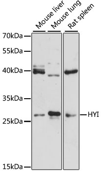 Western blot - HYI Polyclonal Antibody 