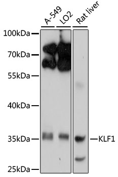 Western blot - KLF1 Polyclonal Antibody 