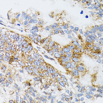 Immunohistochemistry - PDYN Polyclonal Antibody 