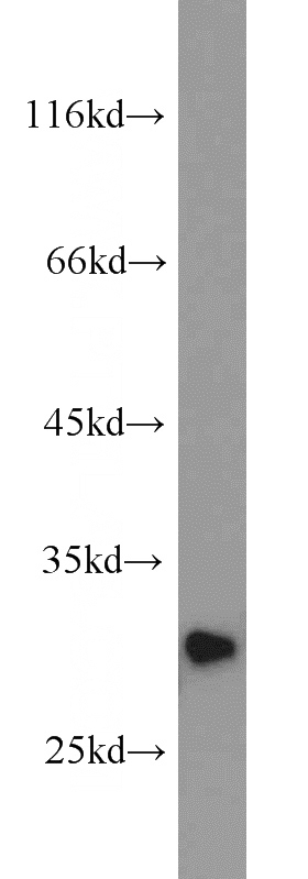 human testis tissue were subjected to SDS PAGE followed by western blot with Catalog No:113486(PAFAH1B2 antibody) at dilution of 1:800