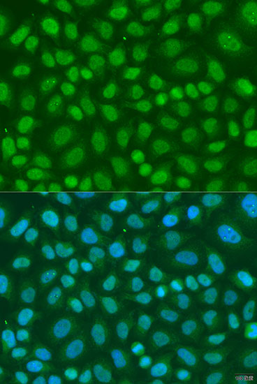 Immunofluorescence - TAF11 Polyclonal Antibody 
