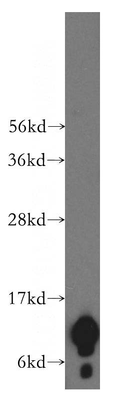 HeLa cells were subjected to SDS PAGE followed by western blot with Catalog No:113060(NDUFA4L2 antibody) at dilution of 1:600