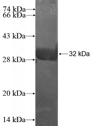 Recombinant Human SP8 SDS-PAGE