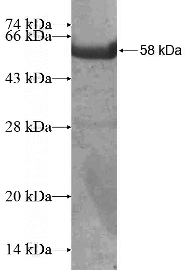 Recombinant Human MAPKAP1 SDS-PAGE
