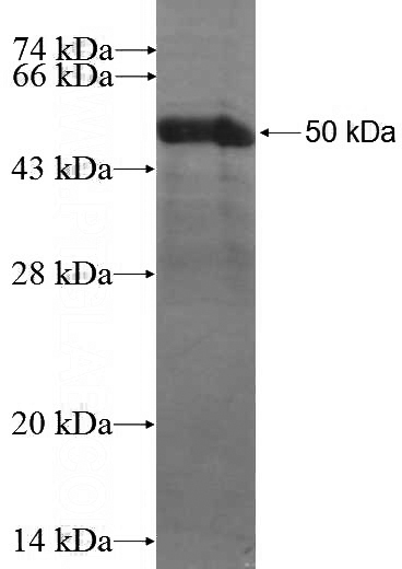 Recombinant Human LGALS3BP SDS-PAGE