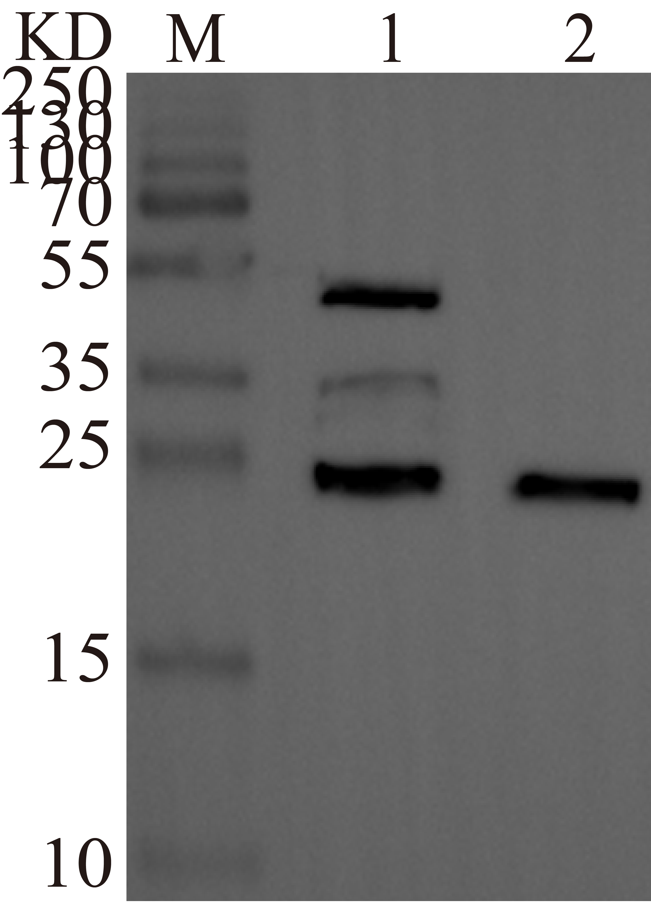 WB result. M: Maker, Lane 1: BCL2-GST, Lane 2: GST-tag (control)