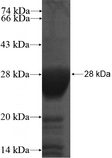 Human TBR1 Recombinant protein (6*His tag)