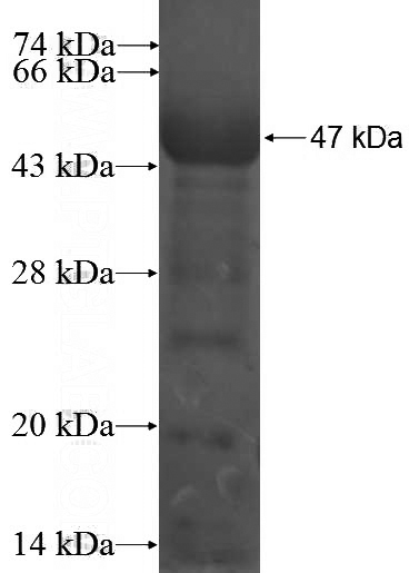 Recombinant Human SFTPB SDS-PAGE