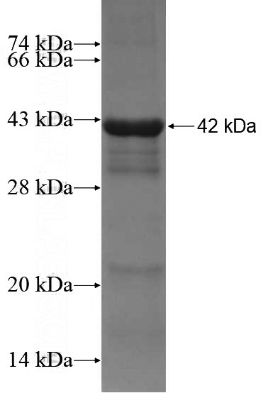 Recombinant Human MTMR2 SDS-PAGE
