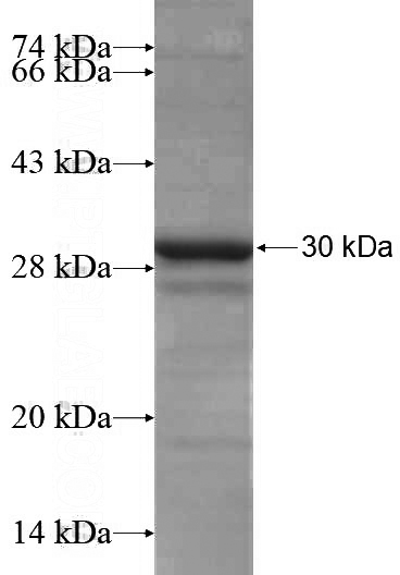 Recombinant Human GDI1 SDS-PAGE