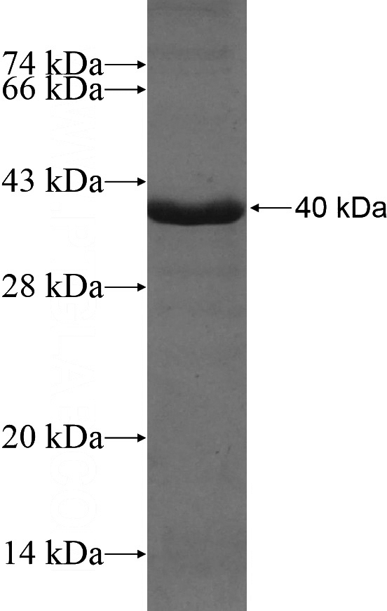 Recombinant Human DOCK1 SDS-PAGE