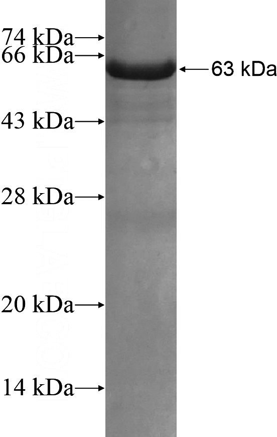 Recombinant Human ASZ1 SDS-PAGE