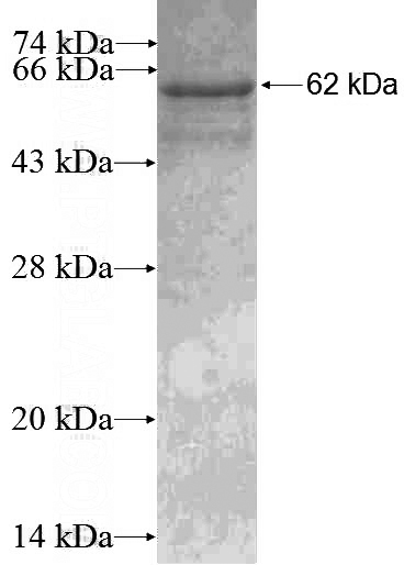 Recombinant Human UBXN11 SDS-PAGE
