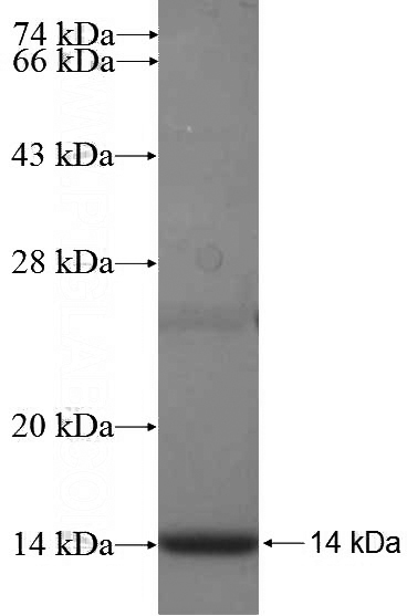 Recombinant Human NPC1L1 SDS-PAGE