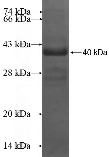 Recombinant Human TTYH1 SDS-PAGE