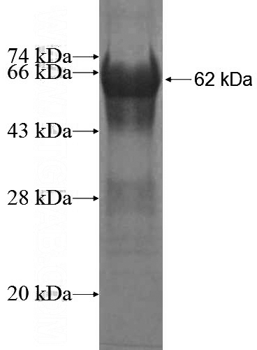 Recombinant Human TBX5 SDS-PAGE