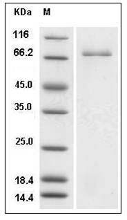 Sus scrofa (Pig) Transferrin / TF Protein (His Tag) SDS-PAGE