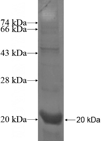 Recombinant Human ARHGEF10L SDS-PAGE