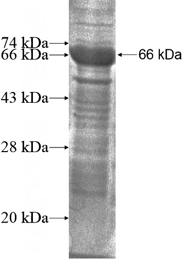 Recombinant Human LRRC23 SDS-PAGE