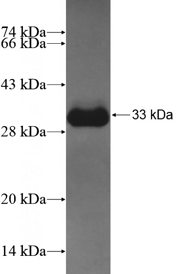 Recombinant Human CHRM2 SDS-PAGE