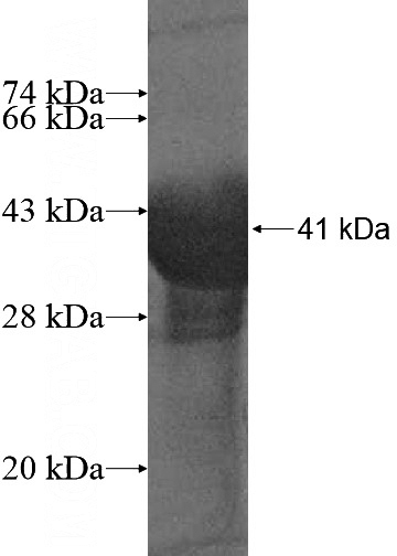 Recombinant Human POLR2I SDS-PAGE