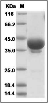 Cynomolgus TNFRSF17 / BCMA Protein (Fc Tag) SDS-PAGE