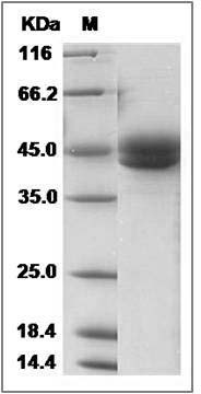 Rat ICOS / AILIM / CD278 Protein (Fc Tag) SDS-PAGE