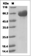 Human KIRREL1 / NEPH1 Protein (His Tag) SDS-PAGE